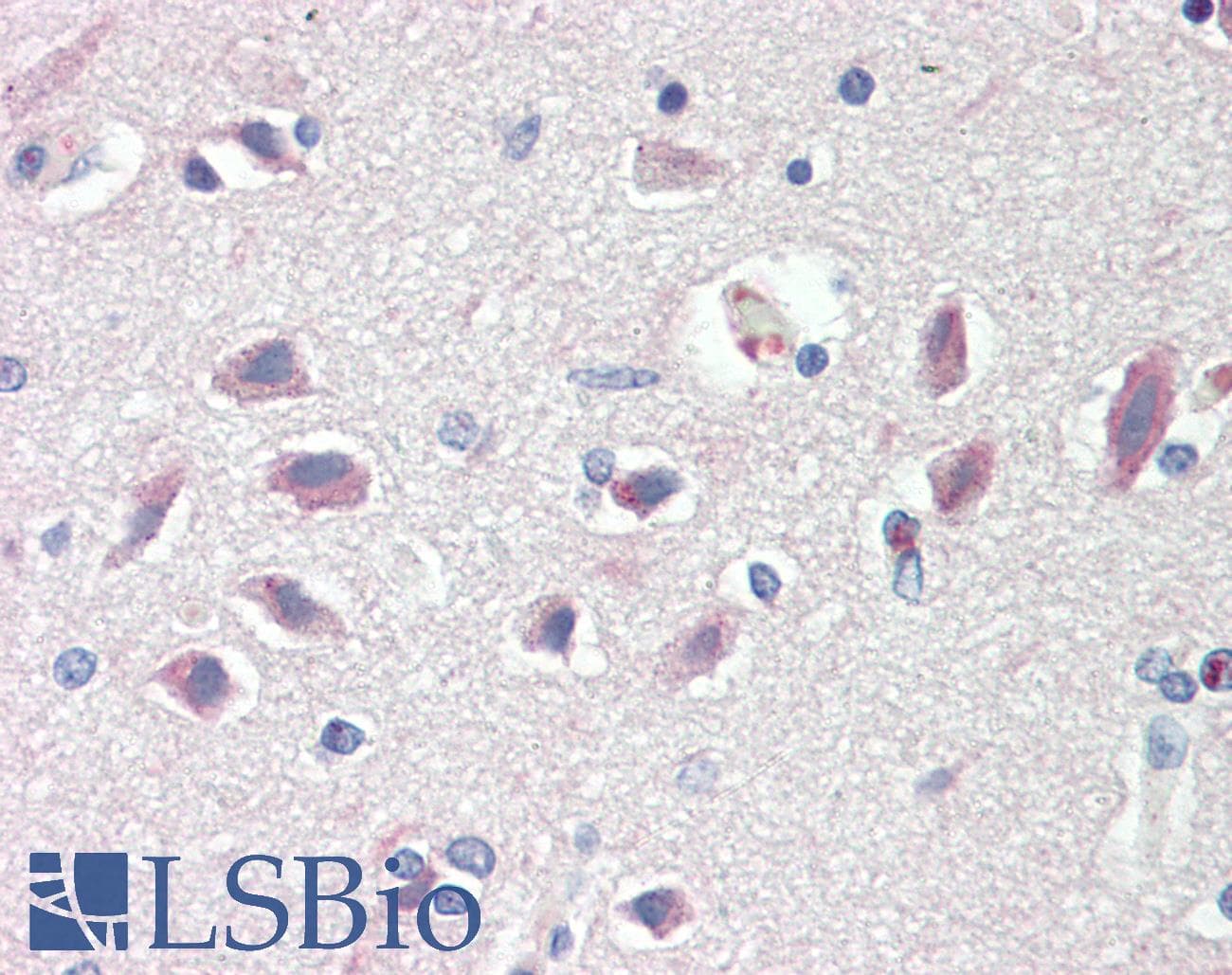 IHC-plus™ Polyclonal Rabbit anti-Human PRKAR1B Antibody (aa106-155, IHC, WB)