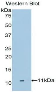 TIMP2 Antibody (aa2-88)