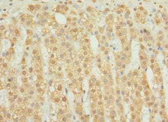 RAB23 Antibody