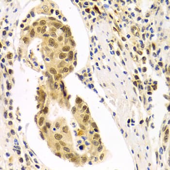HURP / DLGAP5 Antibody