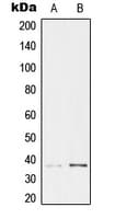 TCF19 / TCF-19 Antibody (Internal)
