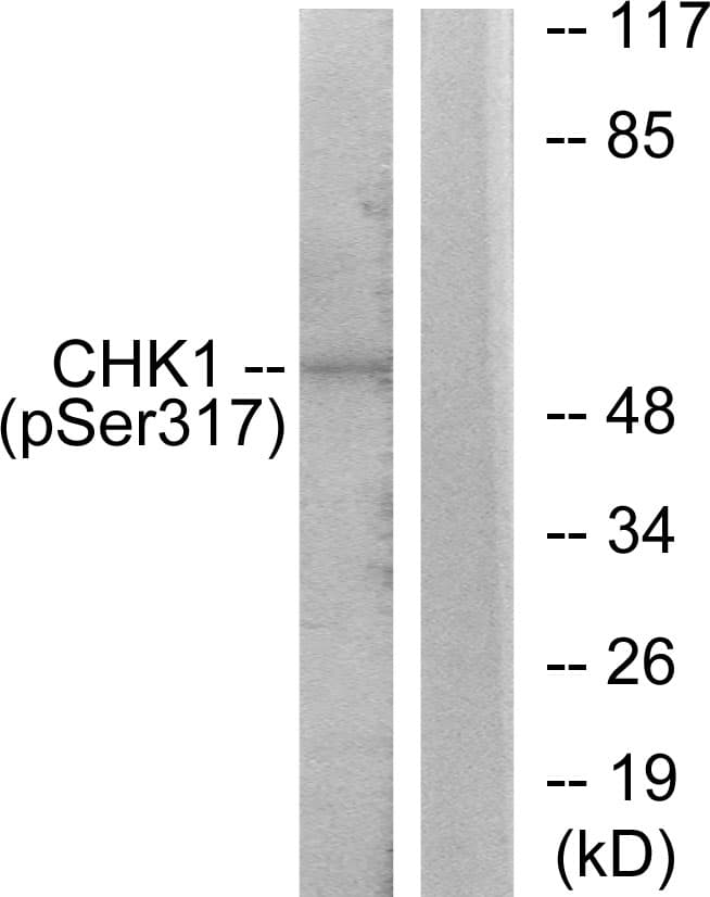 CHEK1 / CHK1 Antibody (phospho-Ser317)