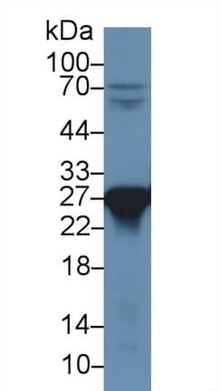 PRDX6 / Peroxiredoxin 6 Antibody (aa1-224)
