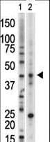 VRK1 Antibody (aa366-396)