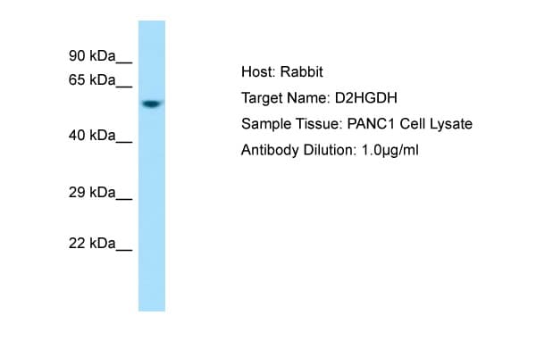 D2HGDH Antibody (aa332-381)