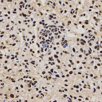 PELP1 Antibody