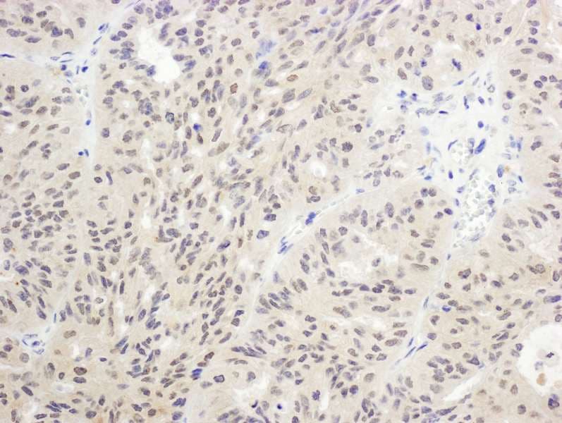 FOXO1 / FKHR Antibody (aa600-C-term)