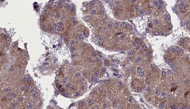 Polyclonal Rabbit anti-Human OR52H1 Antibody (IHC, WB)