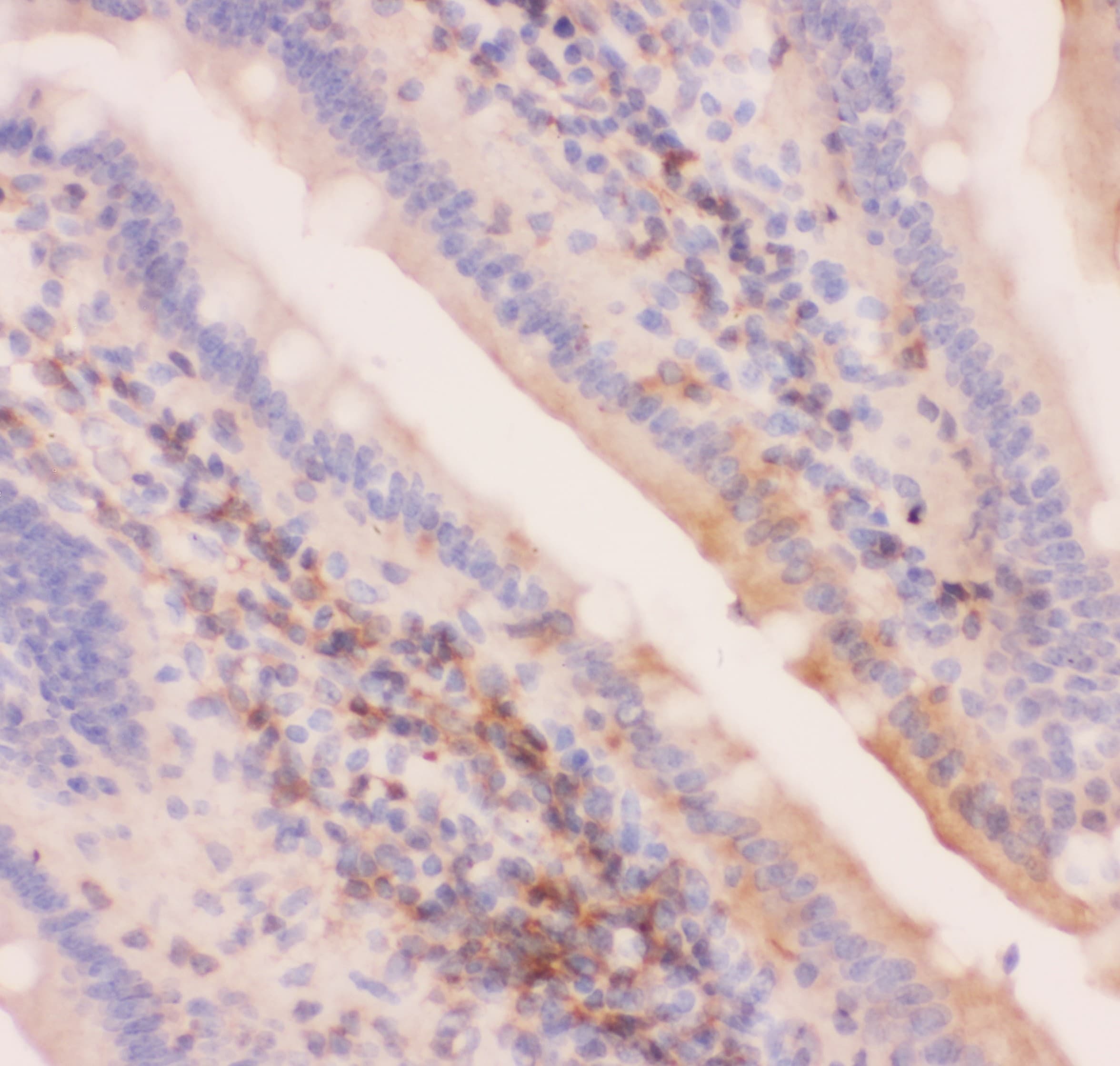 ABCC4 / MRP4 Antibody (aa1-370)