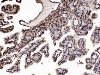 PNP / Nucleoside Phosphorylase Antibody