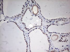 TOP2A / Topoisomerase II Alpha Antibody (aa1100-1531, clone OTI5E6, Carrier-free)