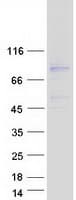 Human CCDC120 Protein (Recombinant Myc-DDK (Flag))
