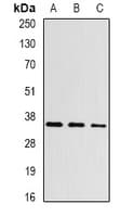 Polyclonal Rabbit anti-Human ASPA Antibody (IF, WB)