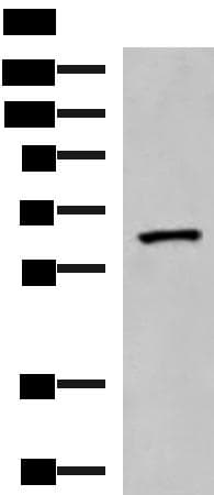 Polyclonal Rabbit anti-Human PDIA5 / PDIR Antibody (IHC, WB)