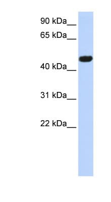 CACNB4 Antibody (aa250-300)