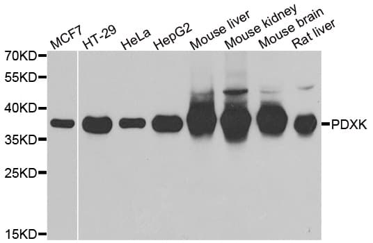 Polyclonal Rabbit anti-Human PDXK / PNK Antibody (IHC, IF, WB)