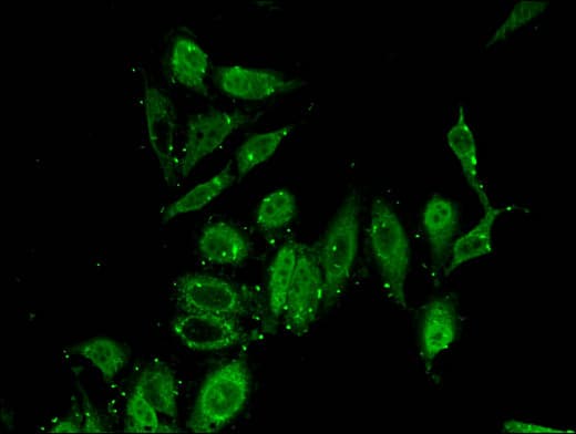 Polyclonal Rabbit anti-Human PITX2 / RGS Antibody (IHC, IF, WB)