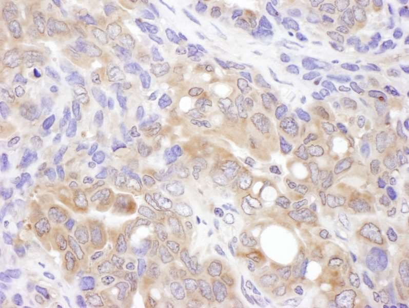 Polyclonal Rabbit anti-Human VCPIP1 Antibody (aa1100-1150, IHC, WB)