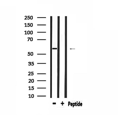 HARS Antibody