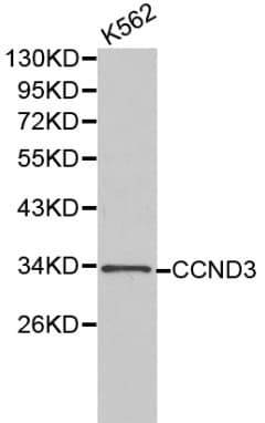 Polyclonal Rabbit anti-Human CCND3 / Cyclin D3 Antibody (IHC, WB)