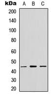 Polyclonal Rabbit anti-Human CX3CR1 Antibody (C-Terminus, WB)