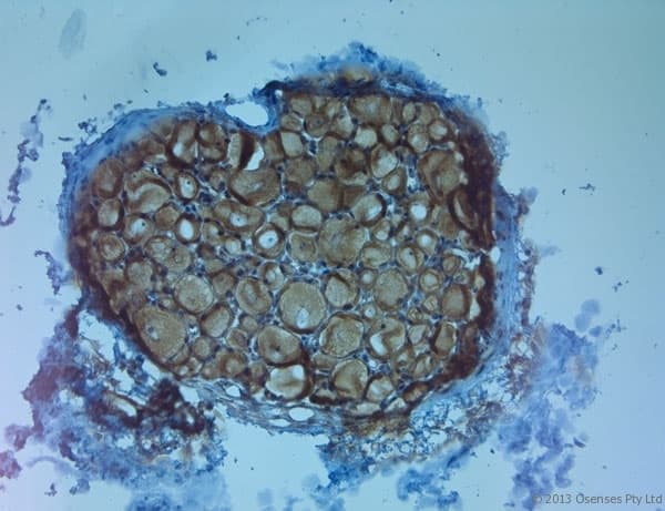 NTRK3 / TRKC Antibody (Extracellular Domain)