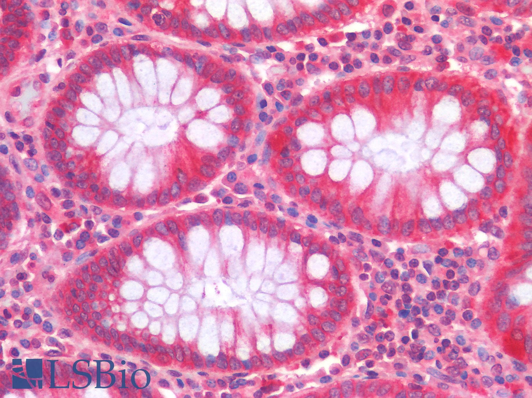 IHC-plus™ Polyclonal Rabbit anti-Human TNFSF4 / OX40L / CD252 Antibody (IHC)