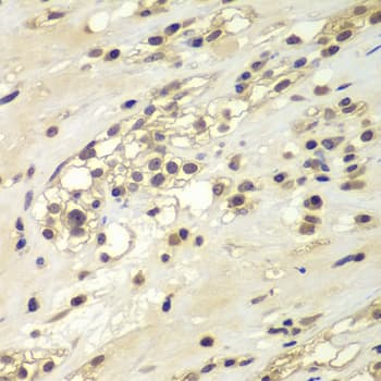 CHEK1 / CHK1 Antibody