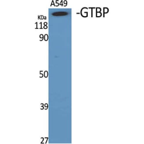MSH6 Antibody (310-390 aa, Internal)