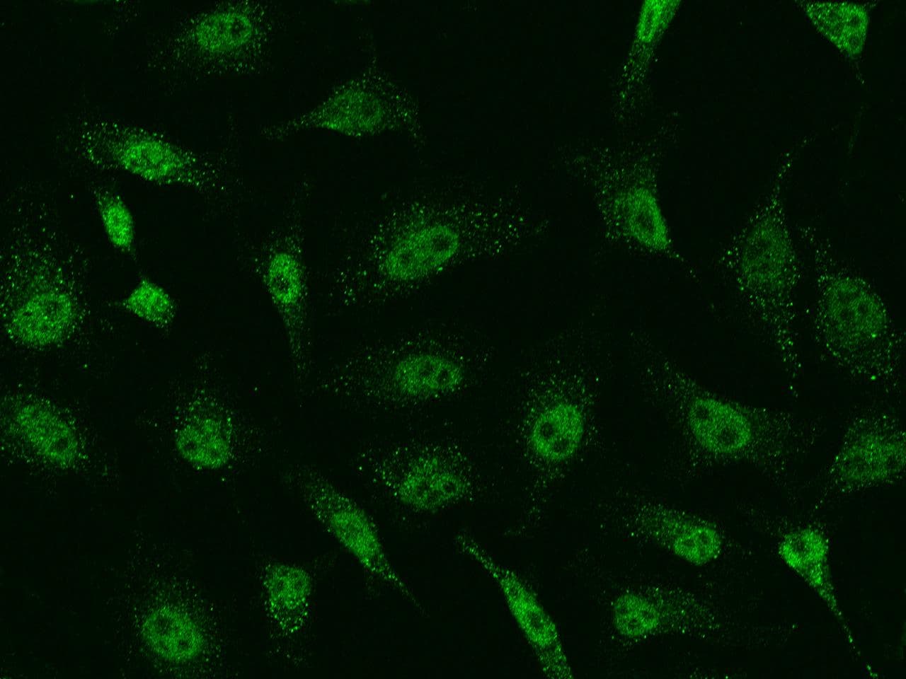 SAP30 Antibody