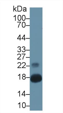 RARRES2 / Chemerin Antibody (aa33-158)