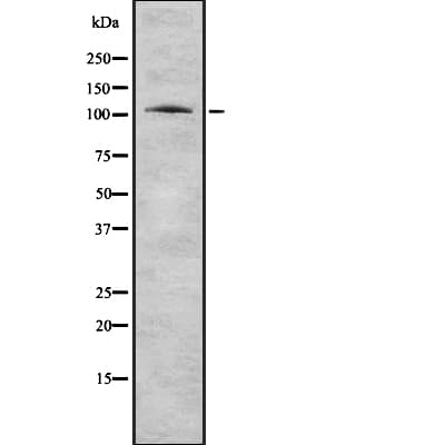 FOLH1 / PSMA Antibody