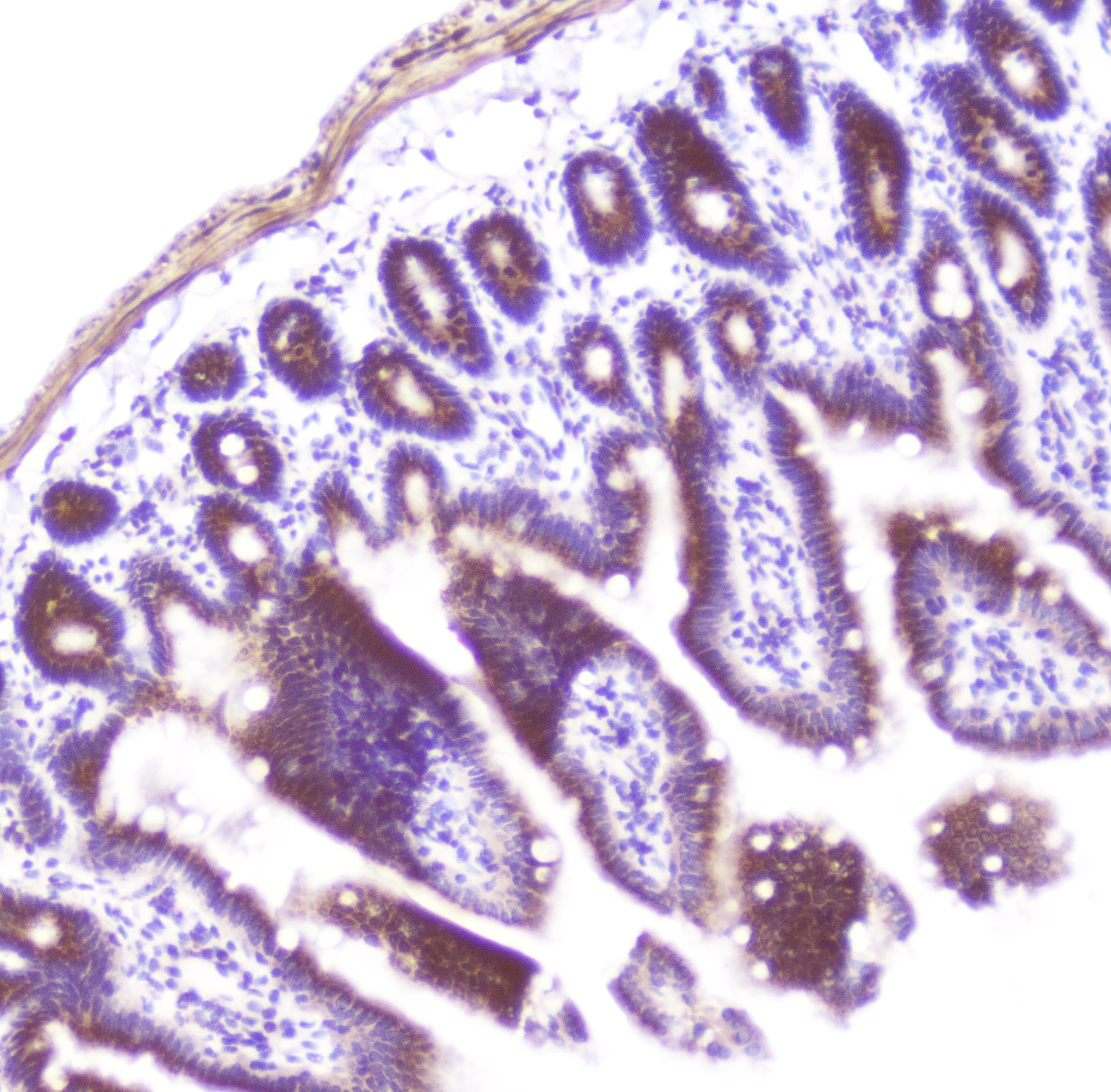 Polyclonal Rabbit anti-Human GOLGA2 / GM130 Antibody (IHC, WB)