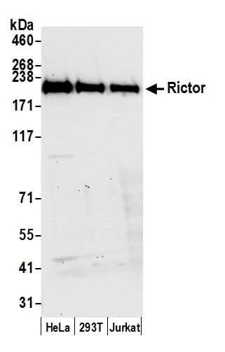 IHC-plus™ RICTOR Antibody (aa1650-C-term)