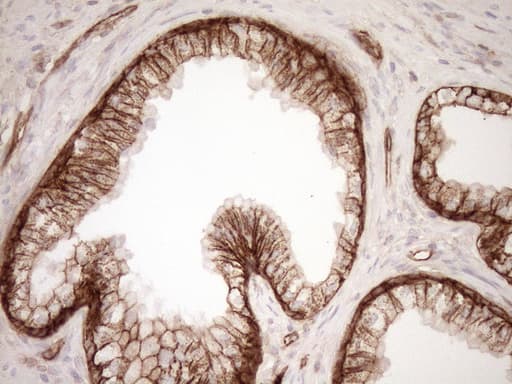 Monoclonal Mouse anti-Human EPLIN Antibody (clone OTI9F3, aa1-275, IHC, WB)