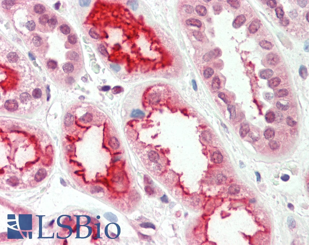PathPlus™ ACE / CD143 Antibody (aa1274-1306)