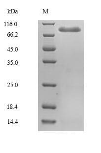 Mouse MASP2 / MASP-2 Protein (Recombinant 6His, N-terminus)