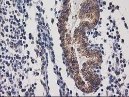 DSTN / Destrin Antibody (clone OTI1D8)