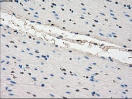 Monoclonal Mouse anti-Human CYPOR / POR Antibody (clone OTI1B11, IHC, IF, WB)