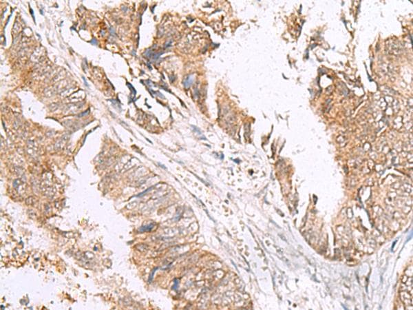 Polyclonal Rabbit anti-Human HLA-E Antibody (IHC)