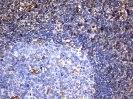 Monoclonal Mouse anti-Human Vimentin Antibody (clone OTI5D7, IHC, WB)