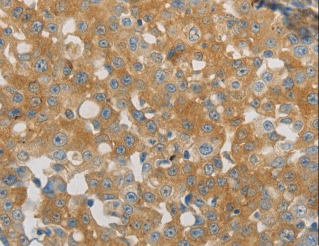 PAP2a / PPAP2A Antibody