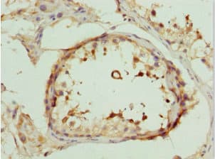 Polyclonal Rabbit anti-Human DEDD Antibody (IHC, WB)