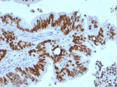 TP53 / p53 Antibody (clone TP53/2092R)