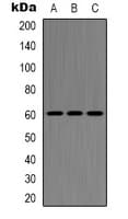 Polyclonal Rabbit anti-Human HDAC2 Antibody (C-Terminus, IHC, WB)