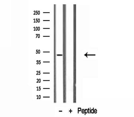 Polyclonal Rabbit anti-Human ADRM1 Antibody (IHC, IF, WB)