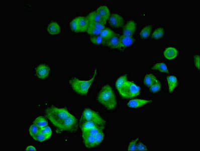 Polyclonal Rabbit anti-Human ATP6V1F Antibody (WB)
