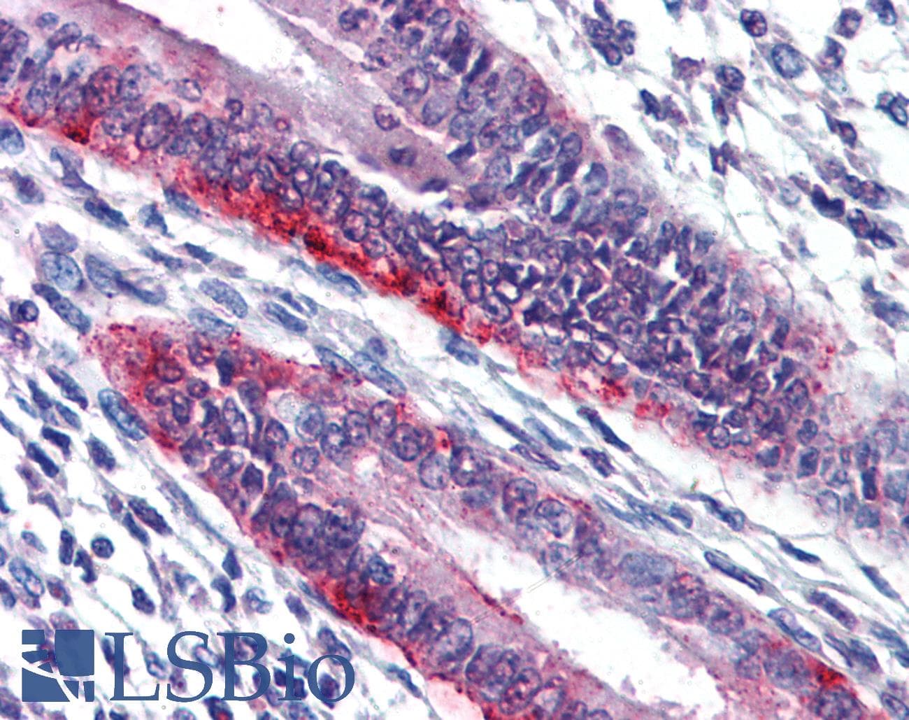 IHC-plus™ MMP7 / Matrilysin Antibody (aa255-267)