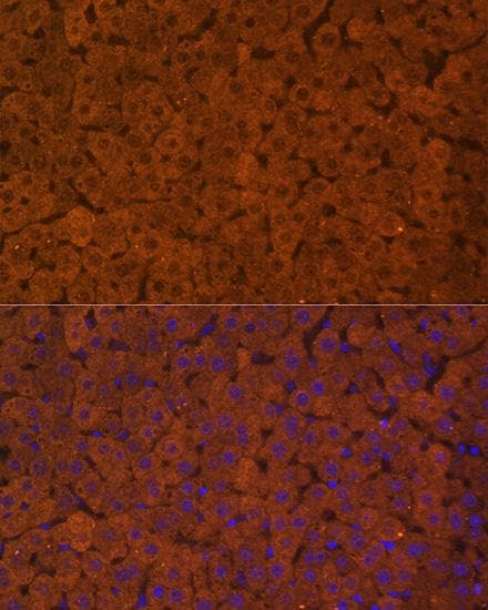 UGT1A / UGT1A1 Antibody