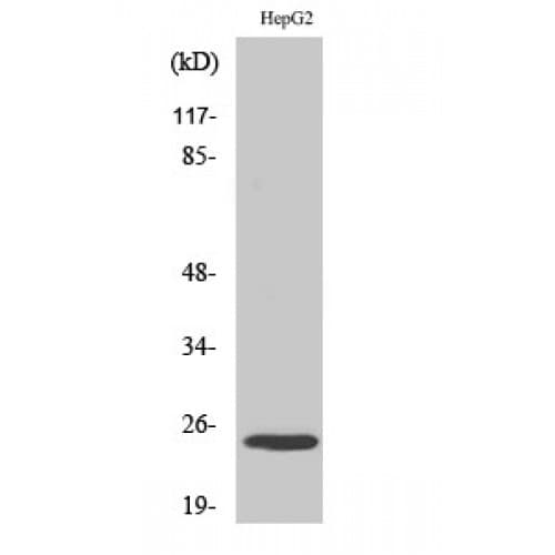 KCNMB4 Antibody (Internal)